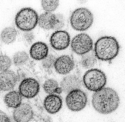 Facts About Orthohantaviruses 🦠