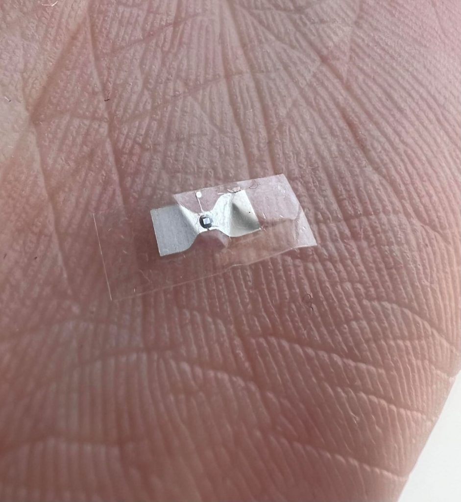 Woman Finds Mysterious Device Stuck to Her Neck – What Is It and Should She Be Worried?