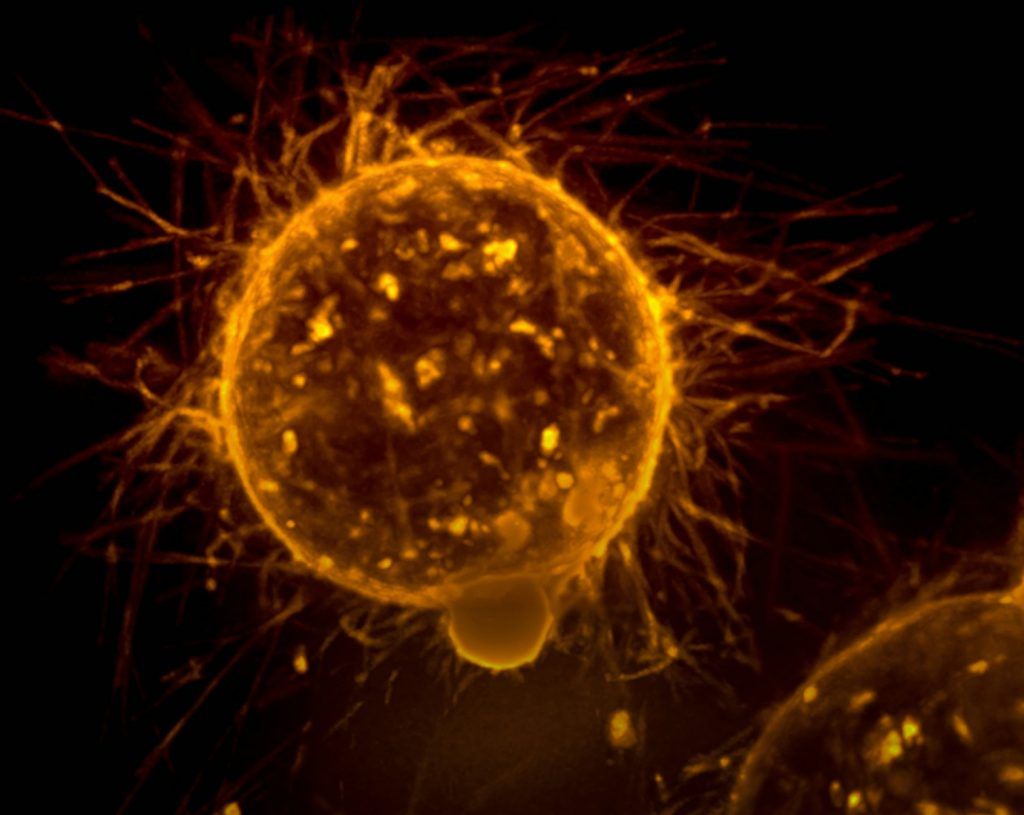The Nobel Prize Winning Discovery of Autophagy – How Fasting Triggers Your Body’s Self-Repair System.
